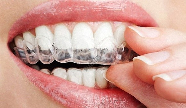 Домашнє відбілювання зубів