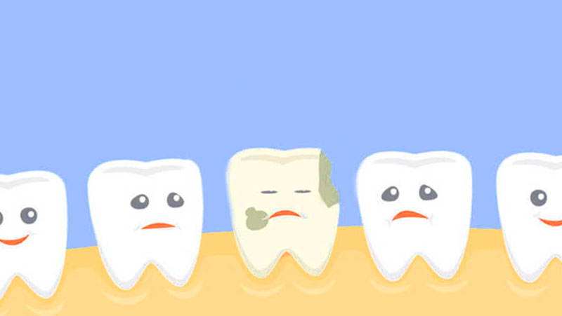 Лікування молочних зубів