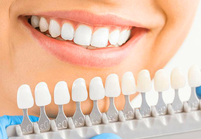 ефект відбілювання зубів