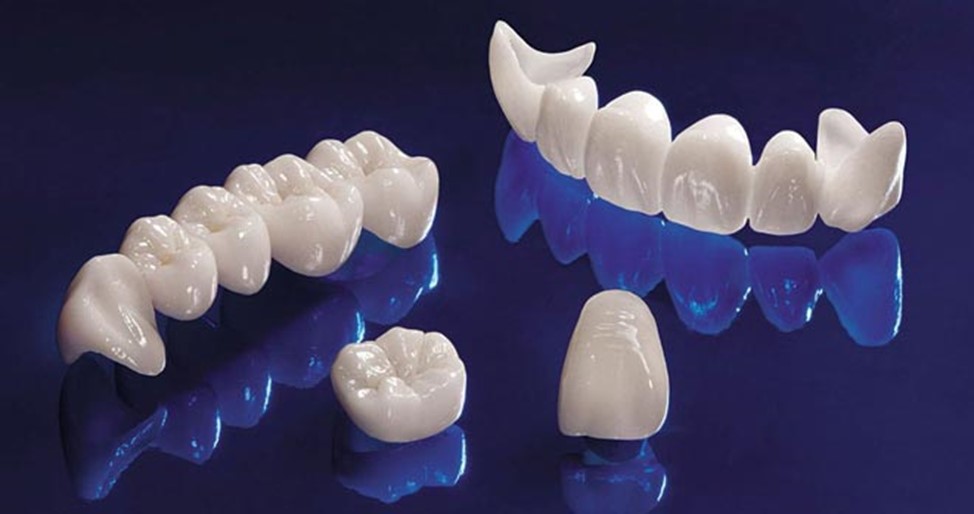 Види протезування зубів